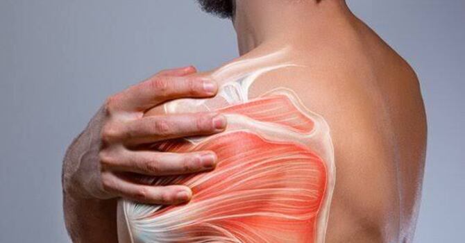 Shoulder Pain When Lifting Weights: Can I Keep Training? image