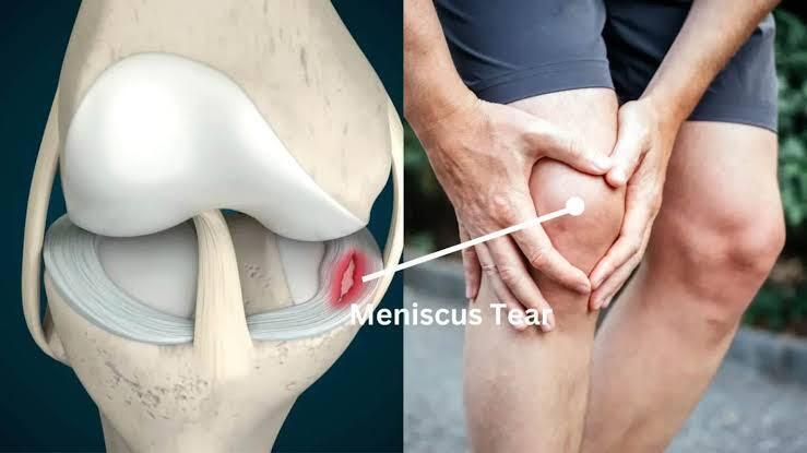 Meniscus injury and inner knee pain physiotherapy assessment in Amersham.